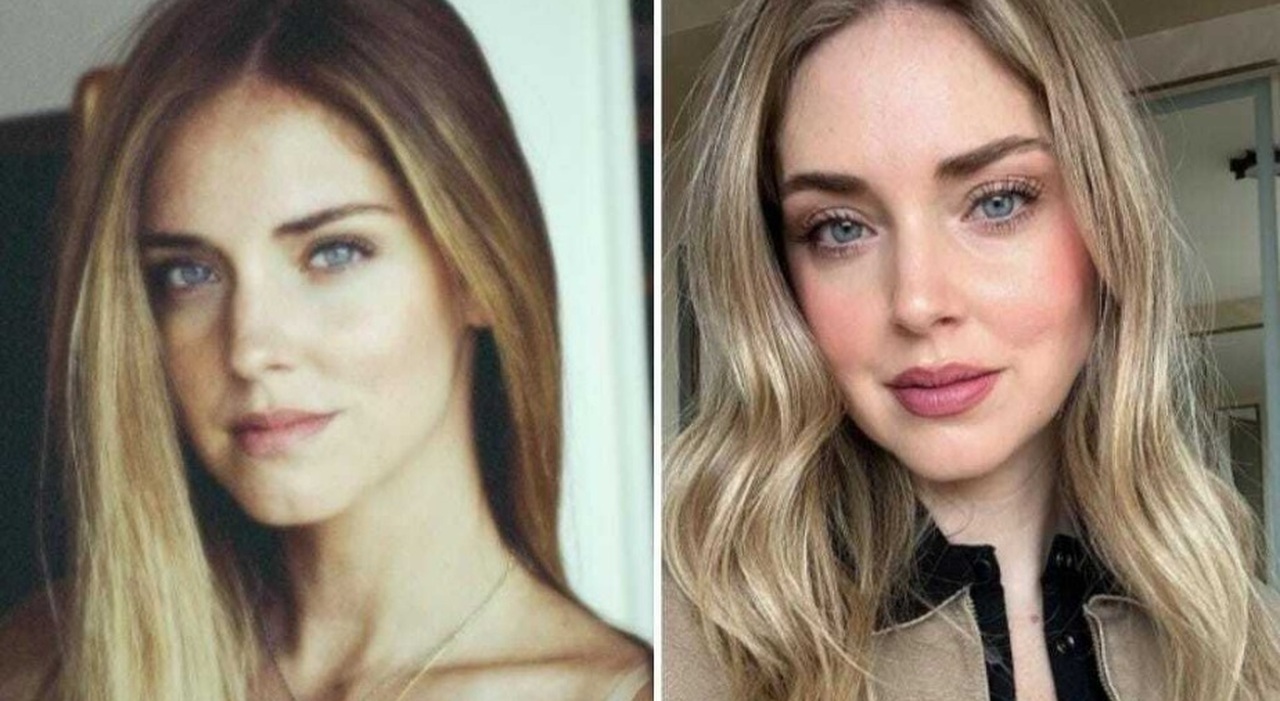 Chiara Ferragni: il confronto tra il suo aspetto nel 2012 e la bellezza attuale